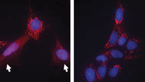 איילת ארז ואיתן גרוס. תאי עכבר רגילים (משמאל) ותאים מהונדסים בהם נמחק גן המעורב בתהליך האפופטוזיס (מימין) נחשפו לגורם המעודד התאבדות של תאים. כתוצאה מכך, תאים רגילים משחררים חלבון המוציא לפועל את תוכנית ההתאבדות (מסומנים בחץ), ואילו התאים המהונדסים אינם מייצרים אותו