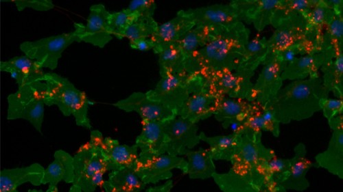 ורד שחם. לאחר שפורקו בתהליך האפופטוזיס, נאכלו אקסונים של תאי עצב (אדום), שמקורם בעובר עכבר, על ידי תאים "מפני פסולת" (ירוק)