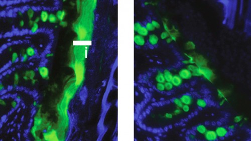ערן אלינב. עכברים רגילים (משמאל) מייצרים שכבה פנימית עבה של חומר אנטי-חיידקי (פס ירוק עבה), ואילו עכברים חסרי אינפלמזום (מימין) אינם מייצרים אותה