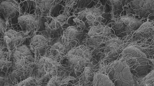ערן סגל. תצלום מיקרוסקופ אלקטרונים סורק של אוכלוסיות חד-תאיים על גבי תאי האפיתל במעי