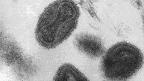 נגיפי Variola במיקרוסקופ אלקטרונים סורק צילום:  CDC/ Dr. Fred Murphy; Sylvia Whitfield