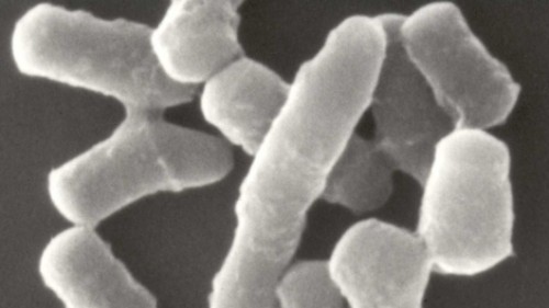 חיידקי Rhodococcus במיקרוסקופ אלקטרונים סורק  צילום: Jerry Sims, Wikipedia