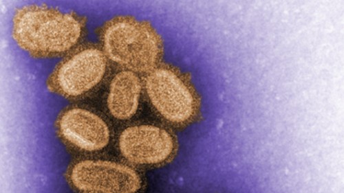 צילום במיקרוסקופ סורק אלקטרונים של נגיף השפעת הספרדית. צולם ב-2005 - לאחר גידול הנגיף בתרבית תאים צילום: CDC/Cynthia Goldshmith
