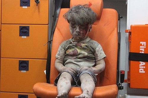 הילד בן החמש. צילום: Mahmud Rslan/Anadolu Agency/Getty Images